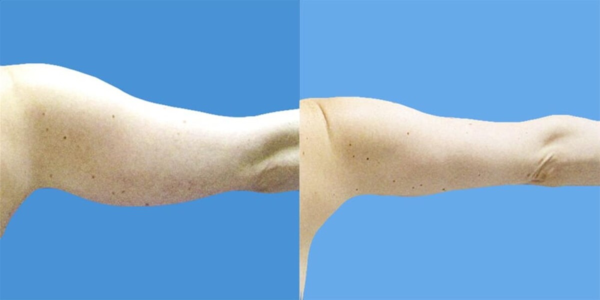 Images Sono Bello Bellevue