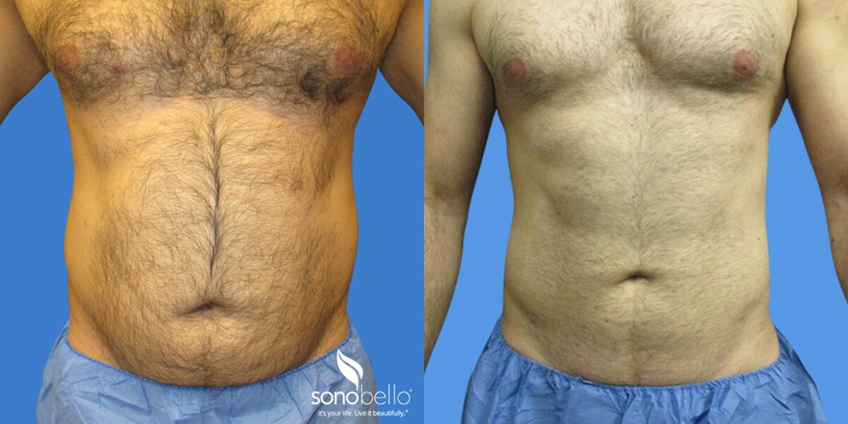 Images Sono Bello Bellevue