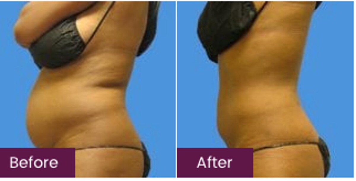 Images Sono Bello Bellevue