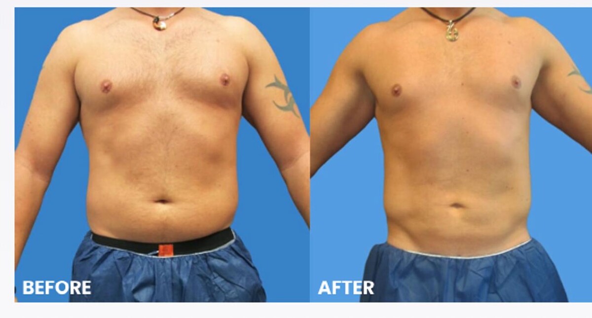 Images Sono Bello Bellevue