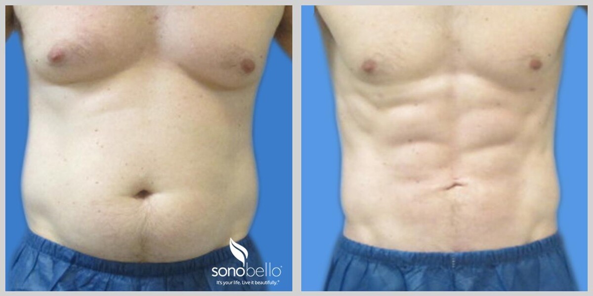 Images Sono Bello Bellevue