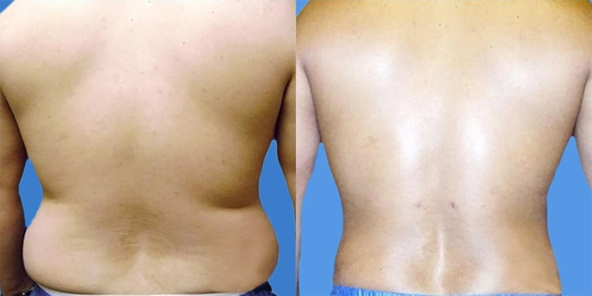 Images Sono Bello Bellevue