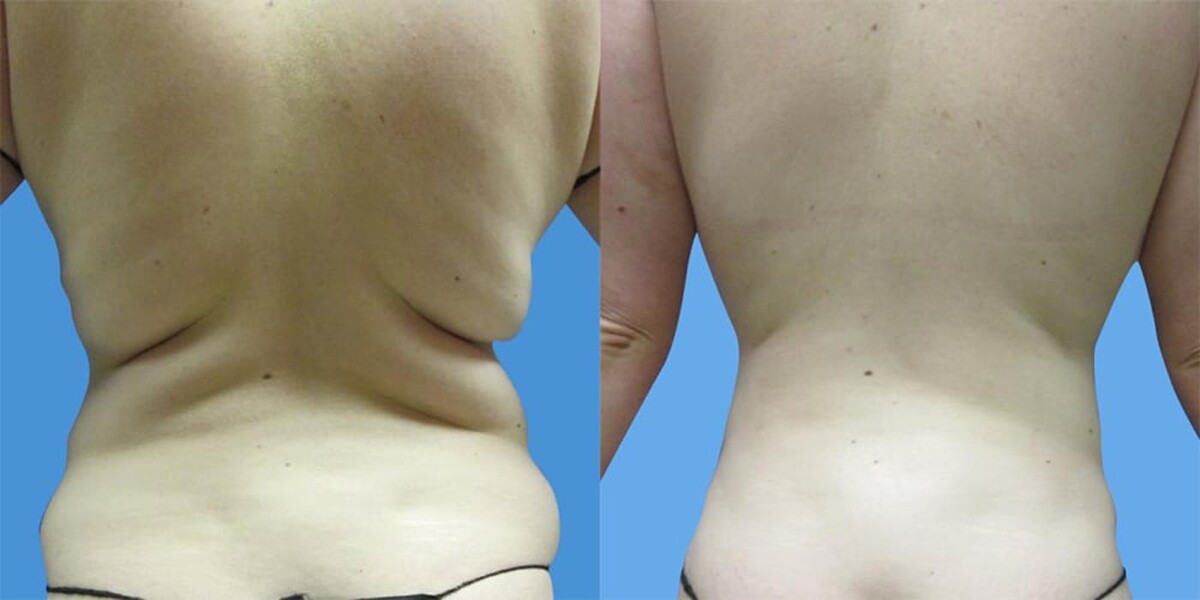 Images Sono Bello Bellevue