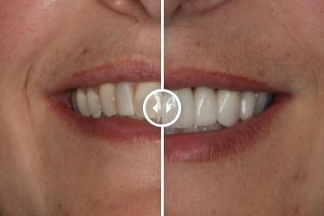 Images Aurora Family Dentistry