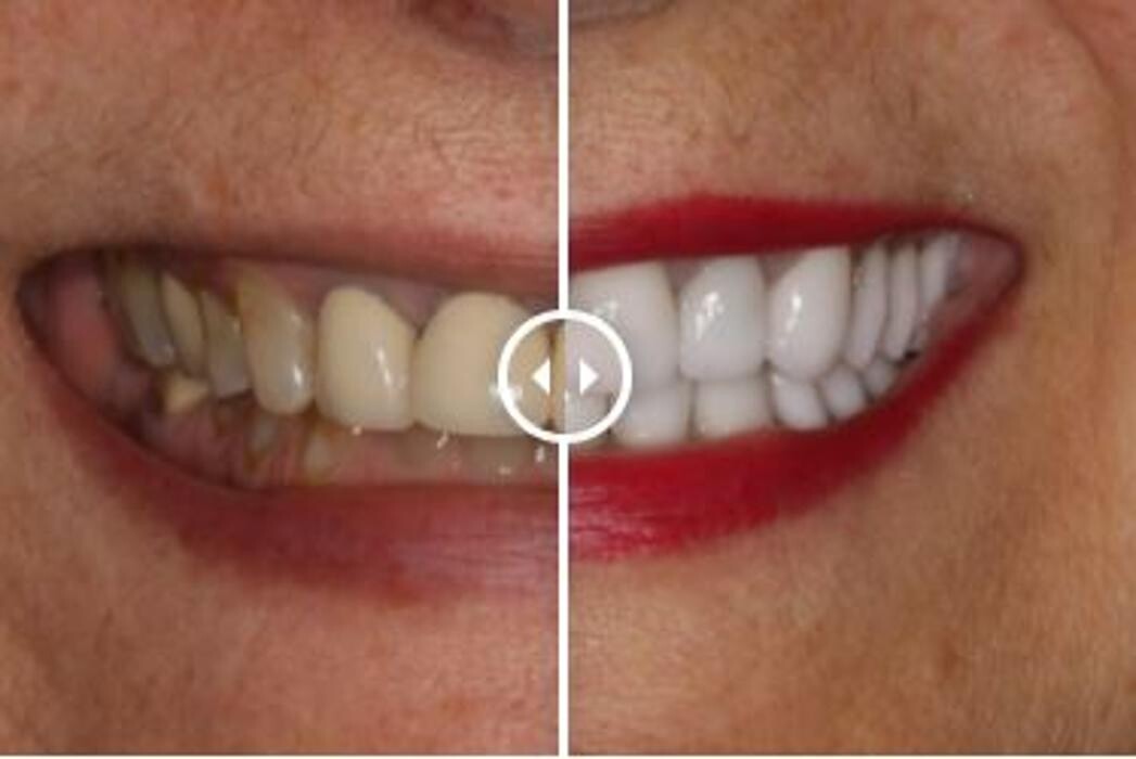 Images Aurora Family Dentistry
