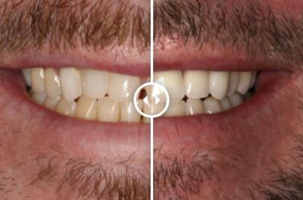 Images Aurora Family Dentistry