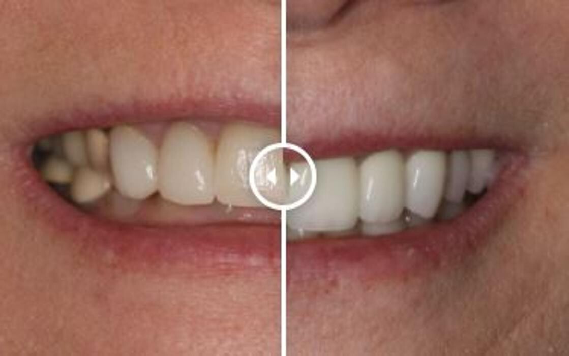 Images Aurora Family Dentistry