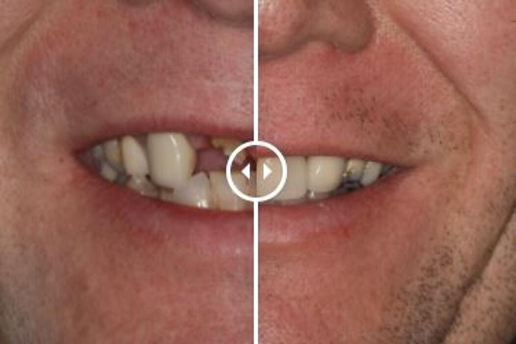 Images Aurora Family Dentistry
