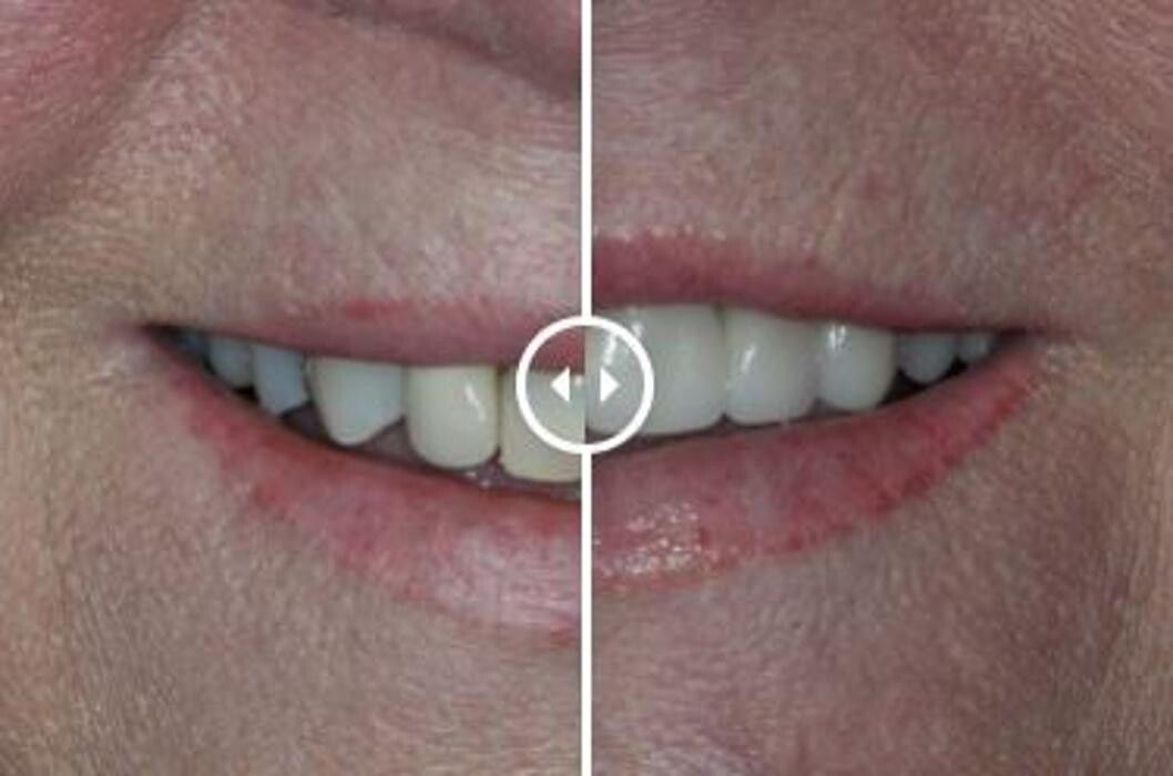 Images Aurora Family Dentistry