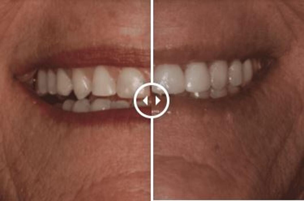 Images Aurora Family Dentistry