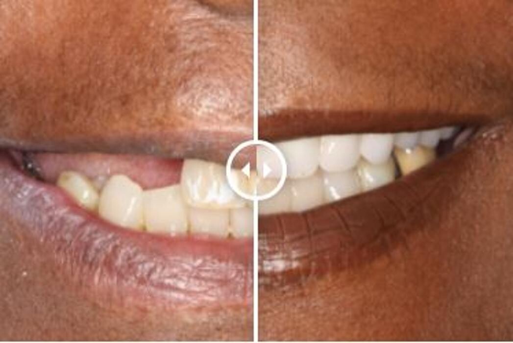 Images Aurora Family Dentistry