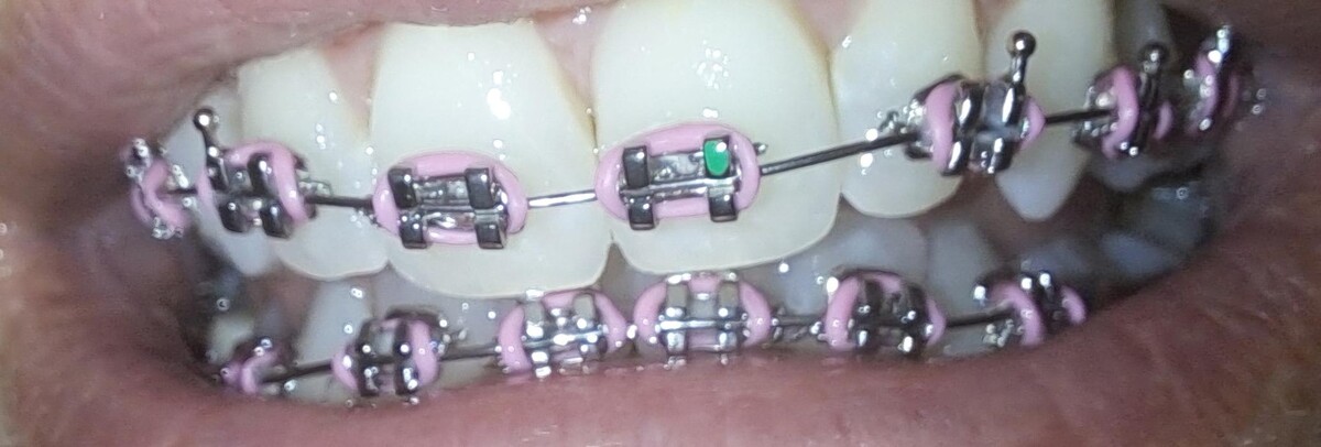 Images Montpelier Family Dentistry
