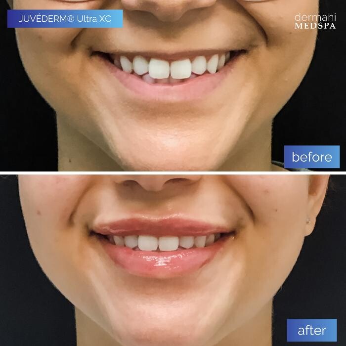 Images dermani MEDSPA Sandy Springs