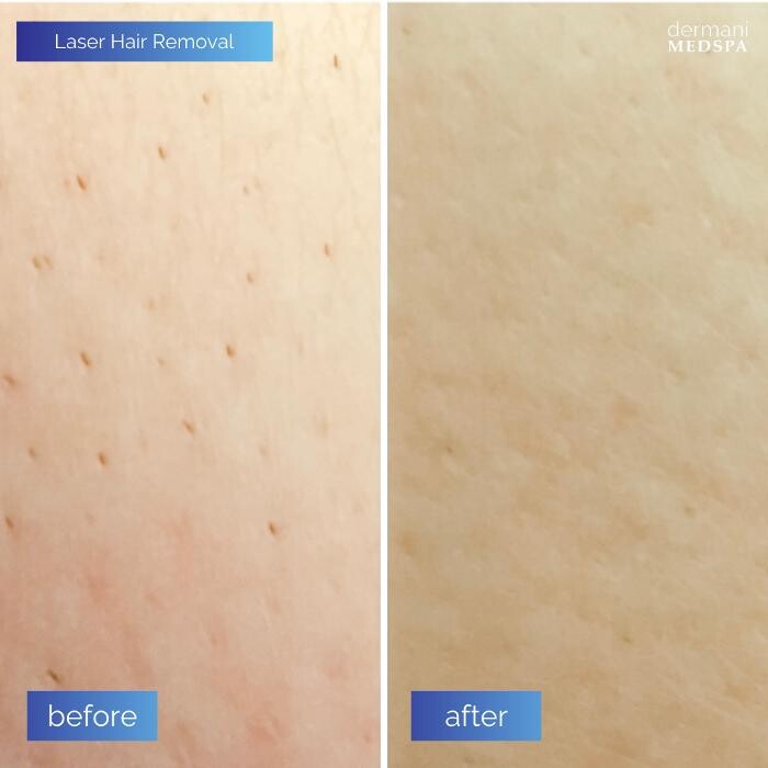 Images dermani MEDSPA Sandy Springs