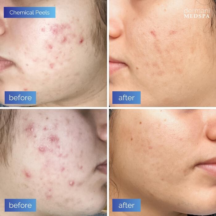 Images dermani MEDSPA Sandy Springs