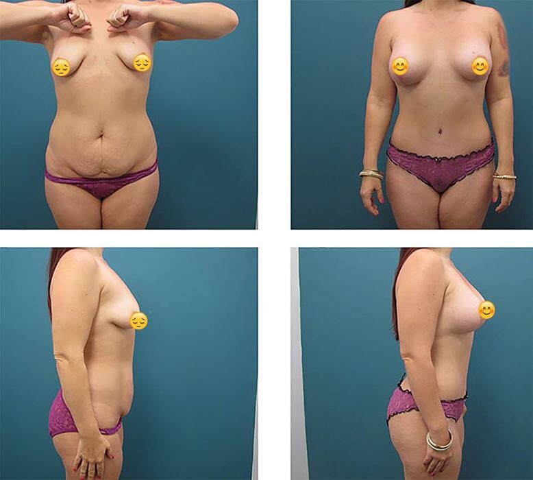 Images Aqua Plastic Surgery - Jupiter