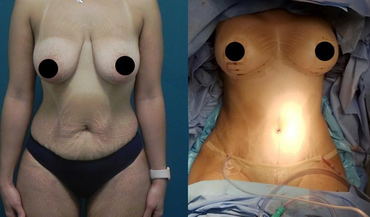 Images Aqua Plastic Surgery - Jupiter