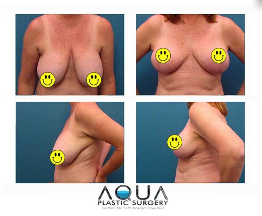 Images Aqua Plastic Surgery - Jupiter