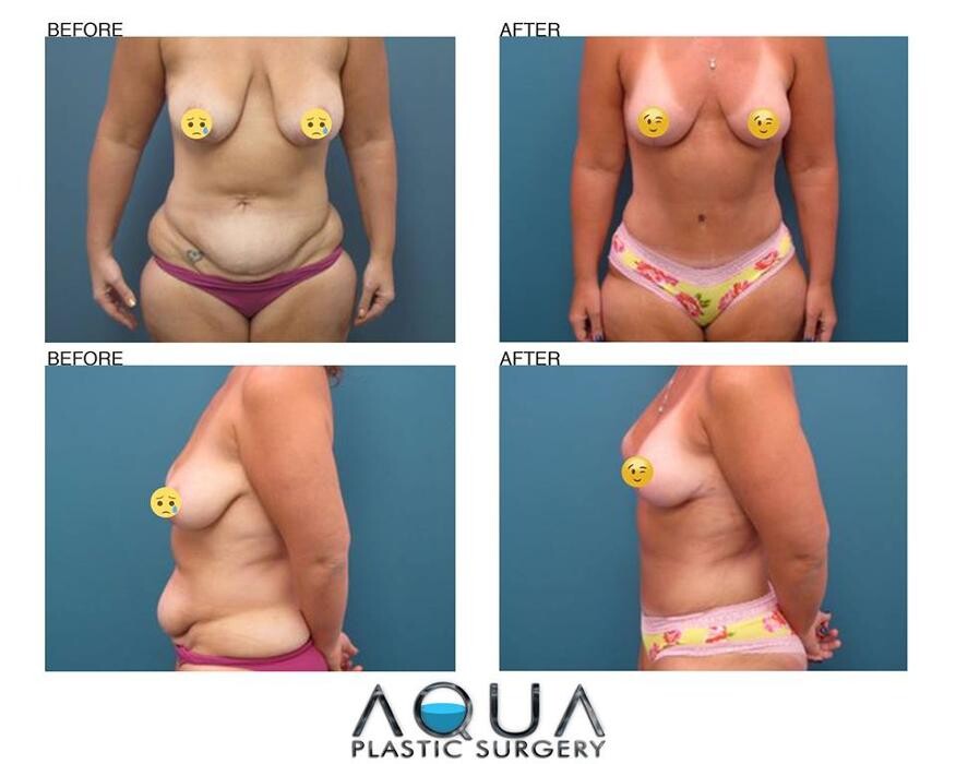 Images Aqua Plastic Surgery - Jupiter