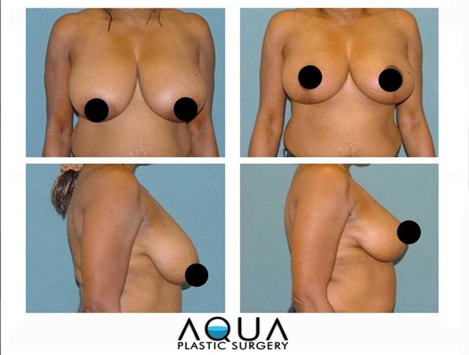 Images Aqua Plastic Surgery - Jupiter