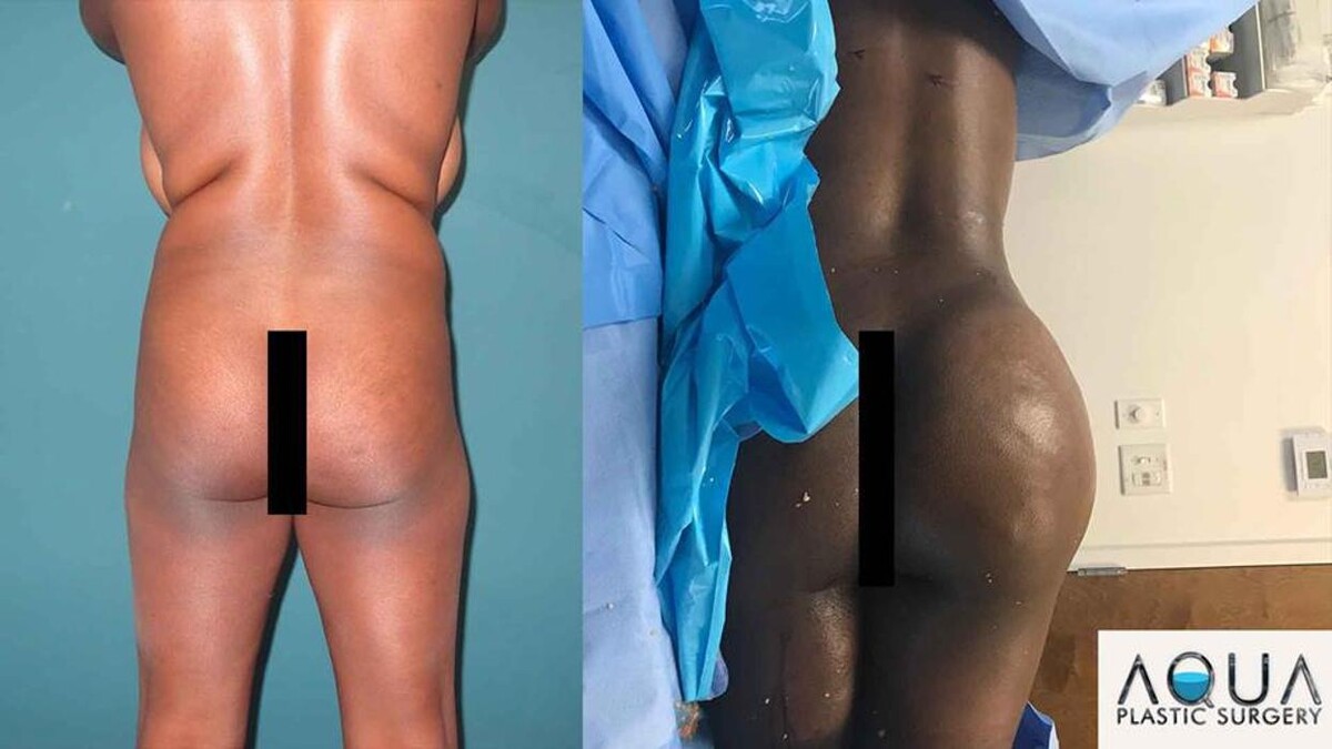 Images Aqua Plastic Surgery - Jupiter