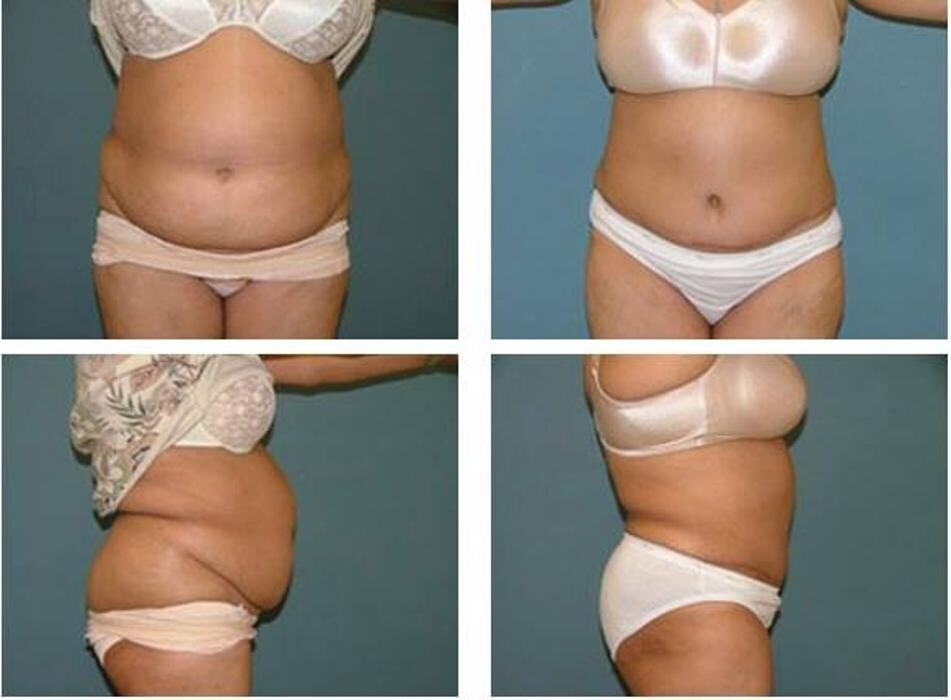 Images Aqua Plastic Surgery - Jupiter