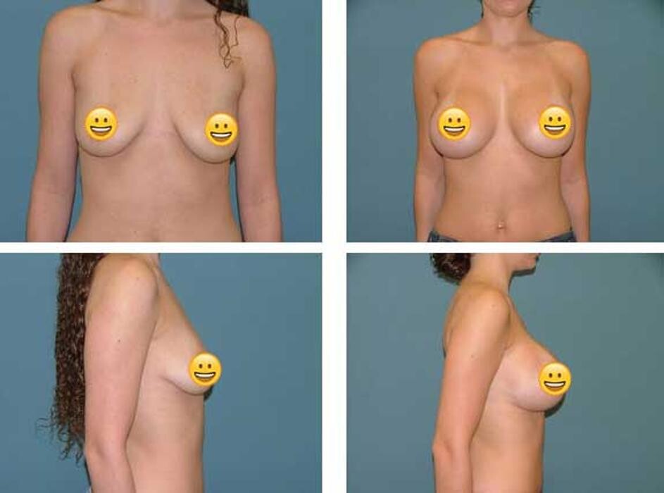 Images Aqua Plastic Surgery - Jupiter