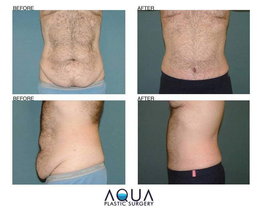 Images Aqua Plastic Surgery - Jupiter