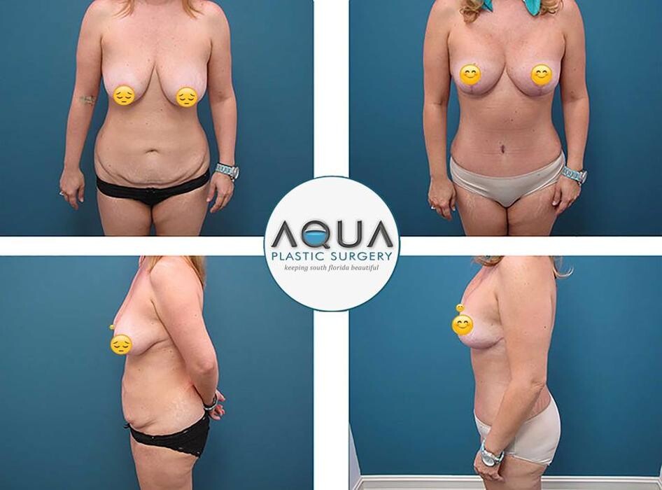 Images Aqua Plastic Surgery - Jupiter