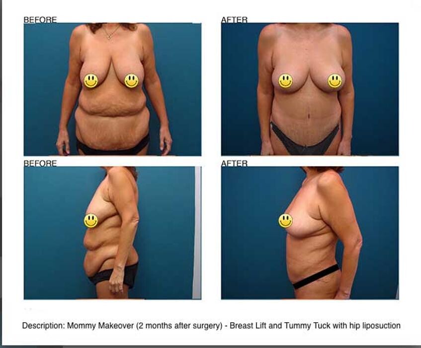 Images Aqua Plastic Surgery - Jupiter