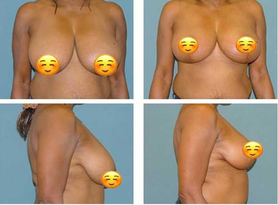 Images Aqua Plastic Surgery - Jupiter