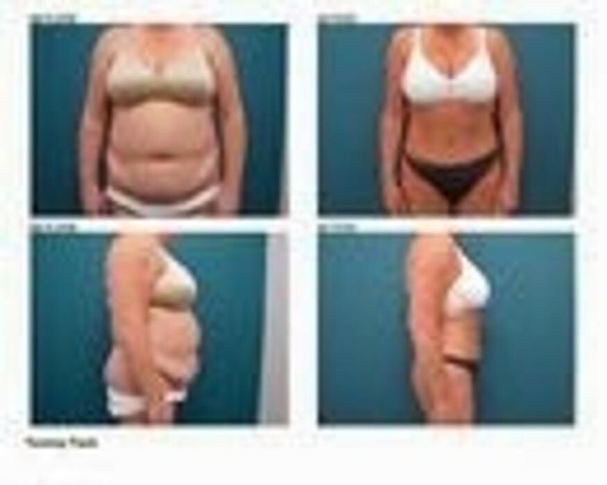 Images Aqua Plastic Surgery - Jupiter