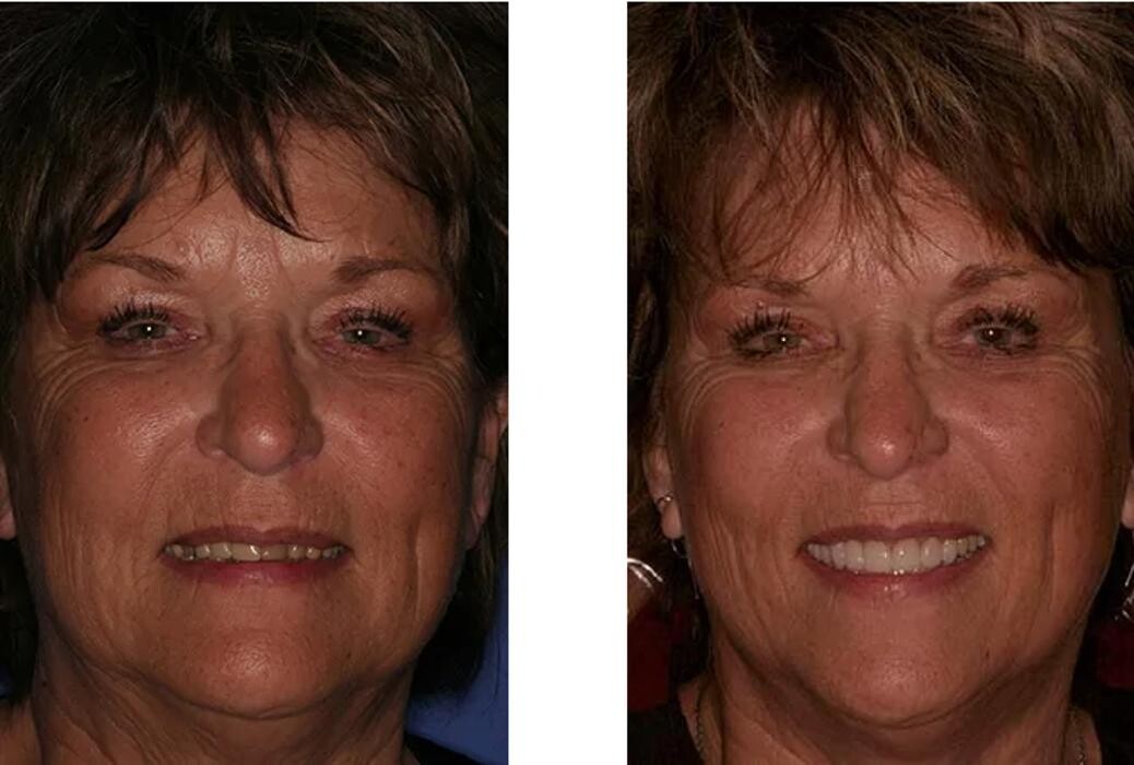 Images Neal C. Johnson DMD - The Billings Dentist