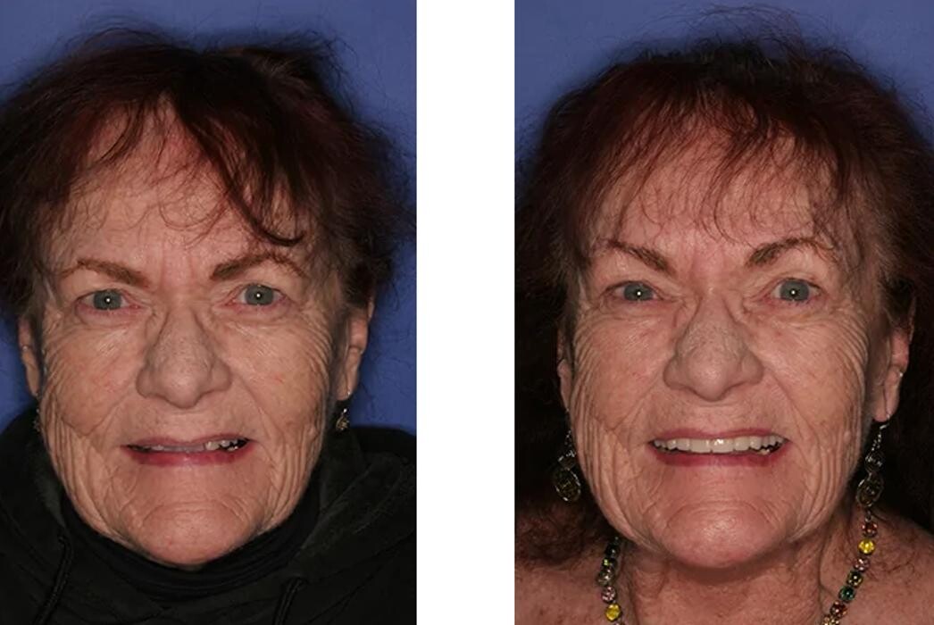 Images Neal C. Johnson DMD - The Billings Dentist