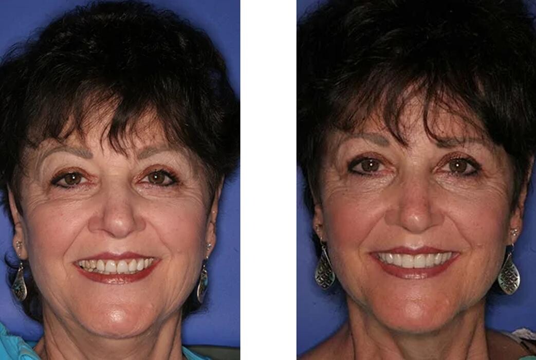 Images Neal C. Johnson DMD - The Billings Dentist