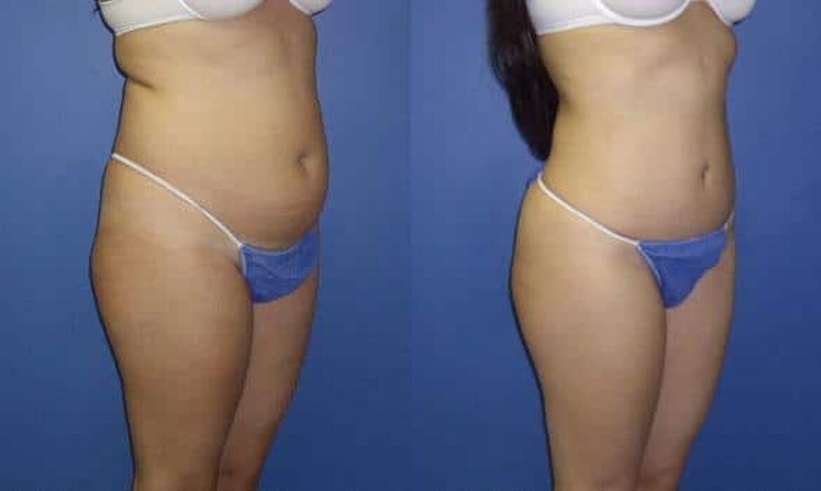 Images Gotham Plastic Surgery