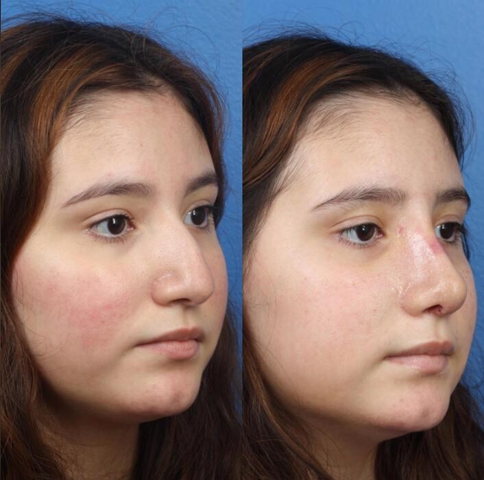 Images Gotham Plastic Surgery