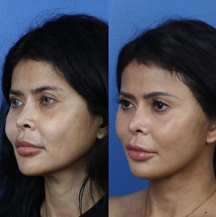 Images Gotham Plastic Surgery