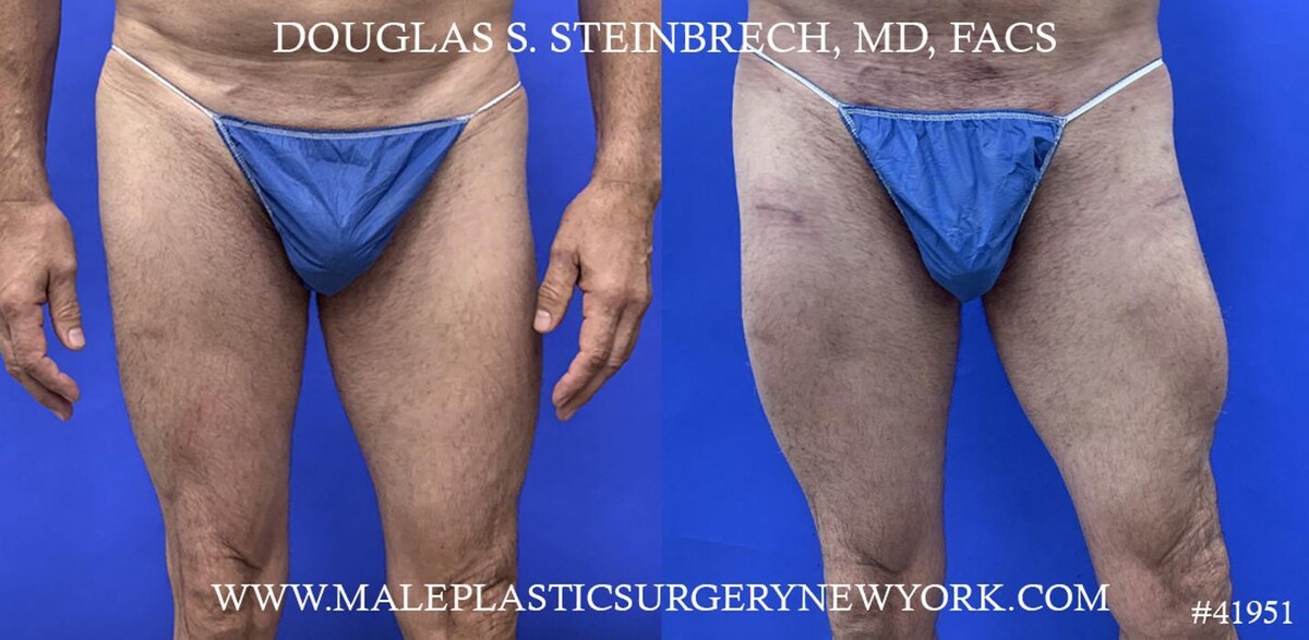 Images Gotham Plastic Surgery