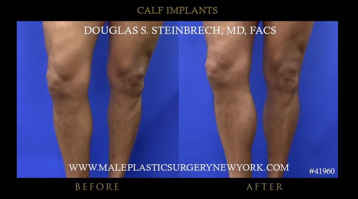 Images Gotham Plastic Surgery