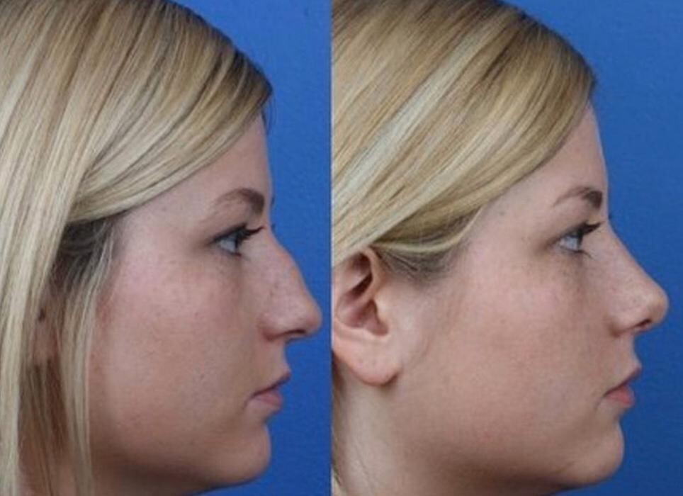 Images Gotham Plastic Surgery