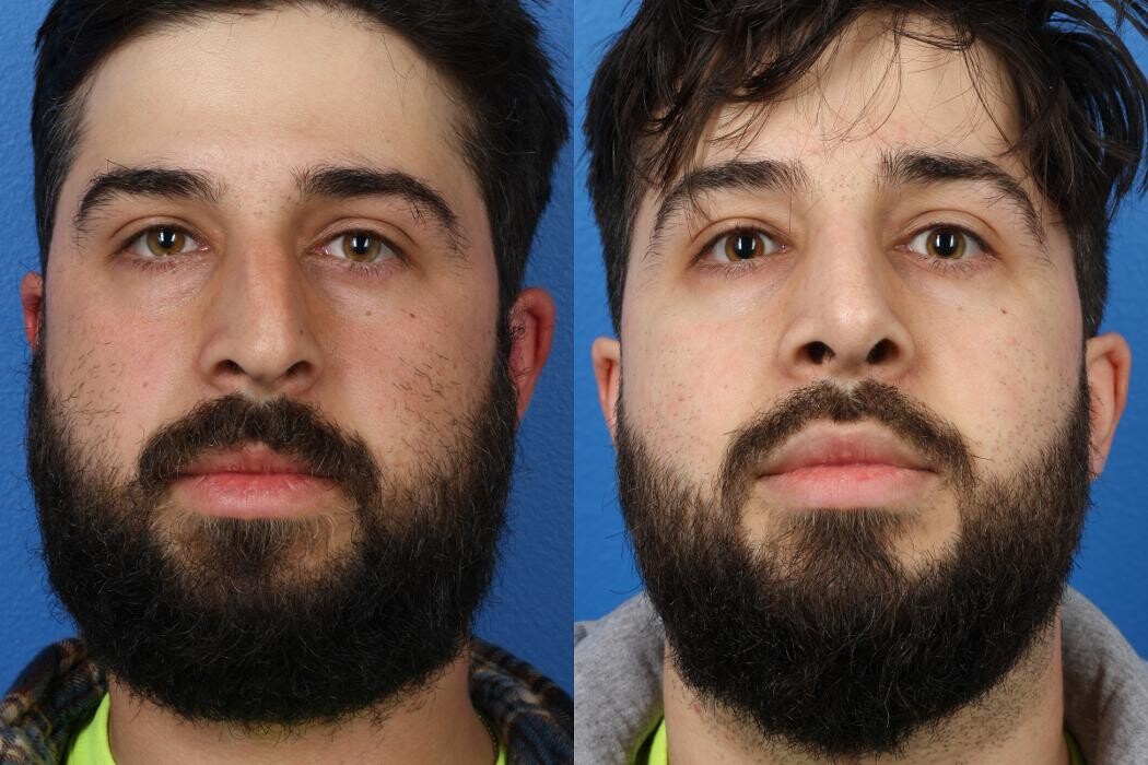 Images Gotham Plastic Surgery