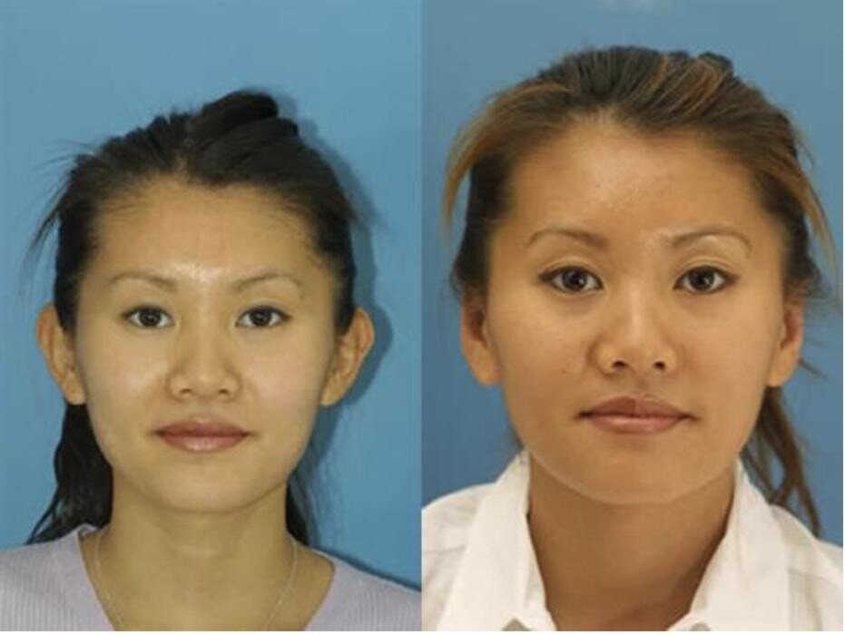 Images Gotham Plastic Surgery