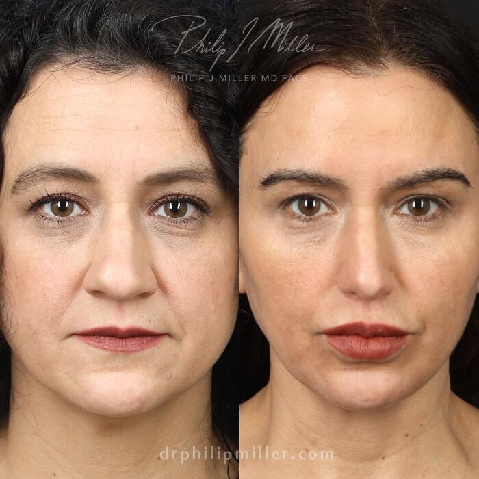 Images Gotham Plastic Surgery