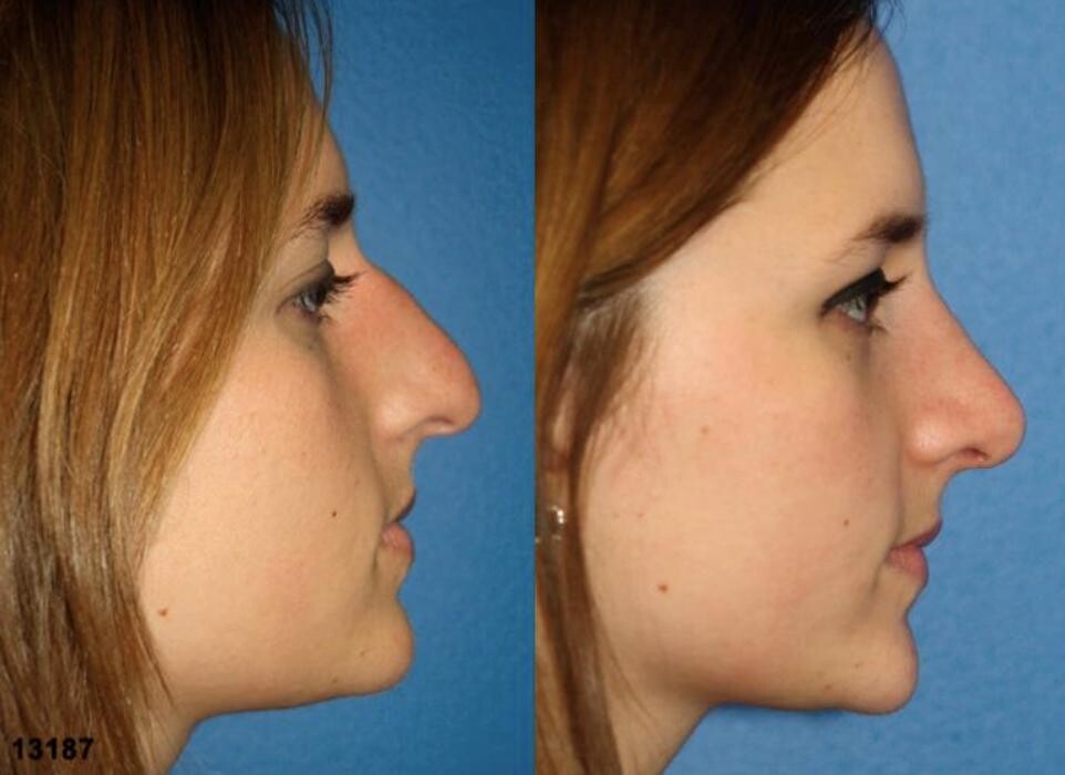 Images Gotham Plastic Surgery