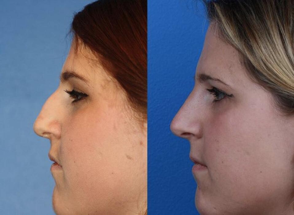 Images Gotham Plastic Surgery