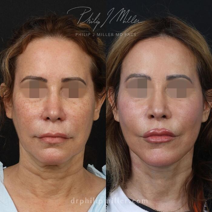 Images Gotham Plastic Surgery