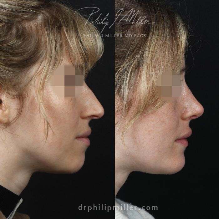 Images Gotham Plastic Surgery