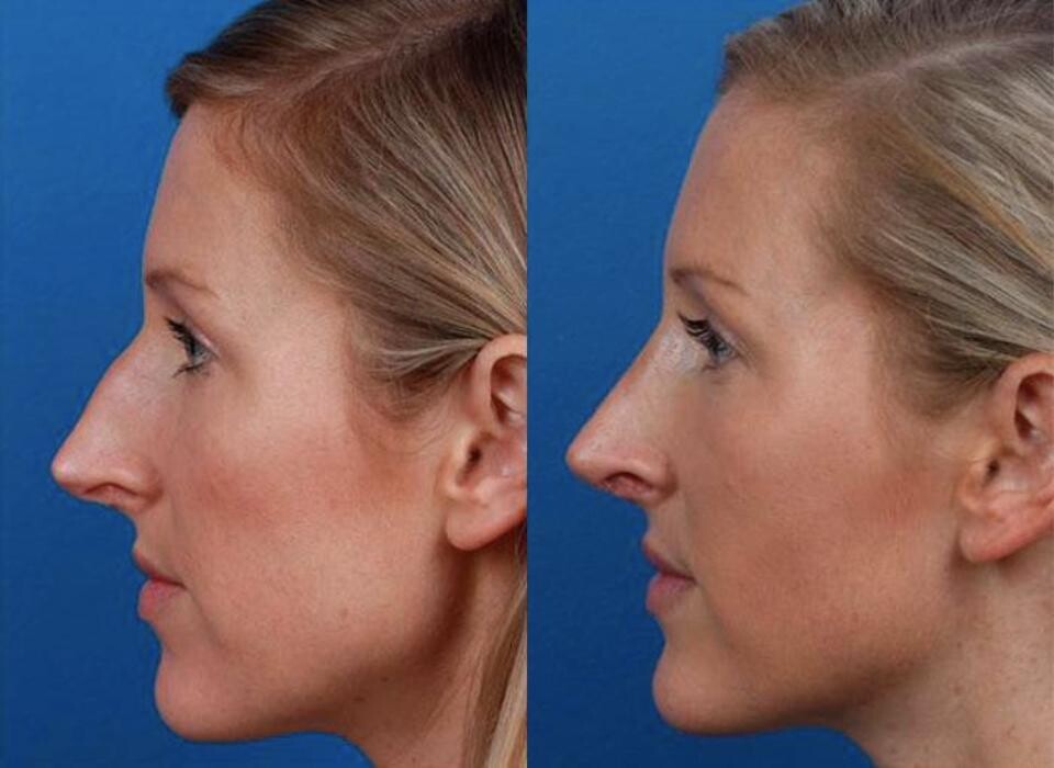 Images Gotham Plastic Surgery