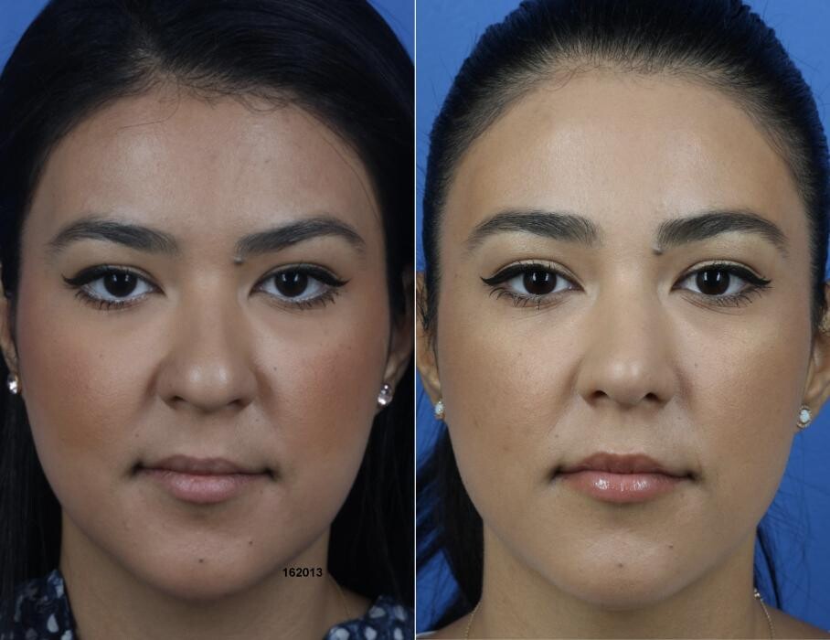 Images Gotham Plastic Surgery